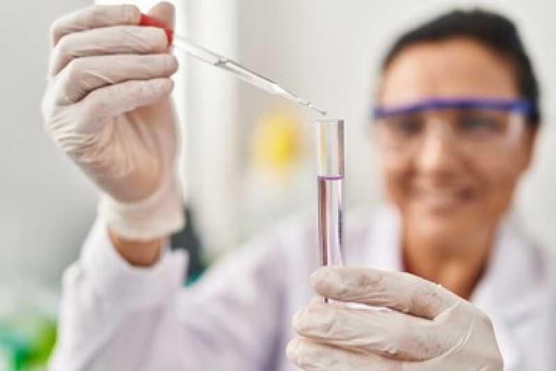 Exame Laboratorial Popular Agendar Vila Palmital - Exame Medicina Laboratorial