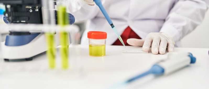 Medicina Laboratorial Exame Agendar Santa Cruz - Exame Periódico Laboratorial